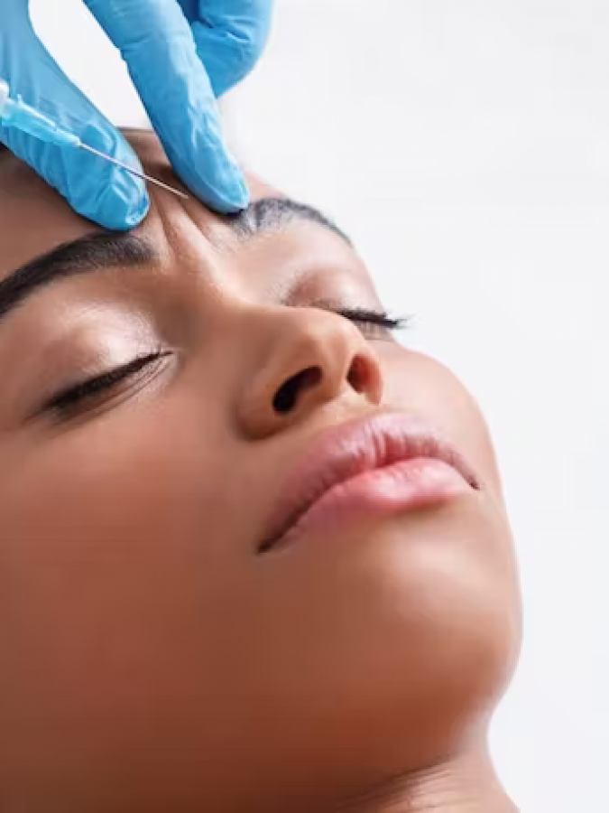 anti-wrinkle-injections